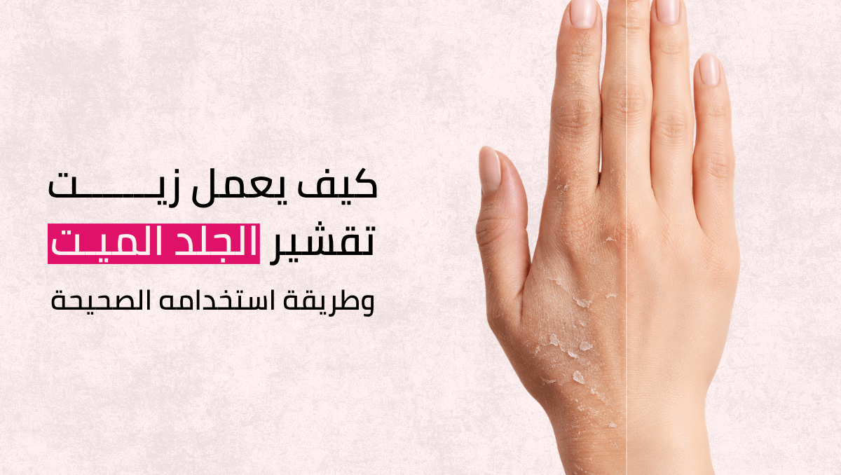 زيت تقشير الجلد